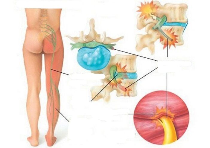 Types and causes of pain